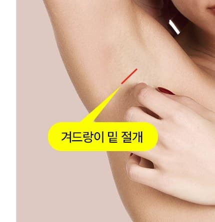 겨드랑이 절개법 이미지