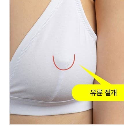 유륜주위 절개법 이미지